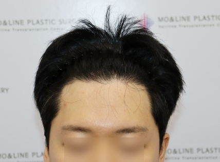 치료후기 이미지